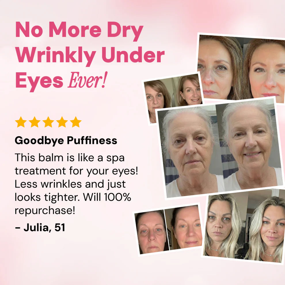 Revive Tired Eyes – Hydrating & Anti-Wrinkle Eye Balm