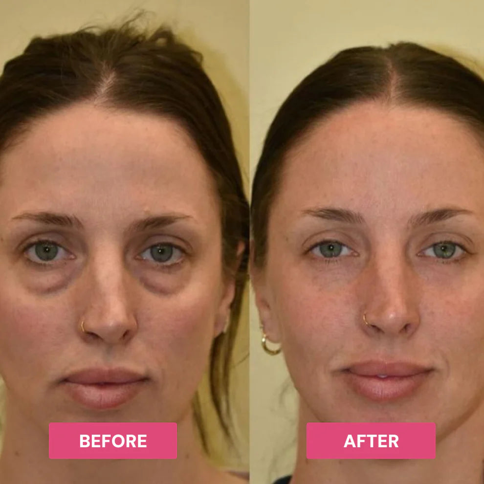 Revive Tired Eyes – Hydrating & Anti-Wrinkle Eye Balm