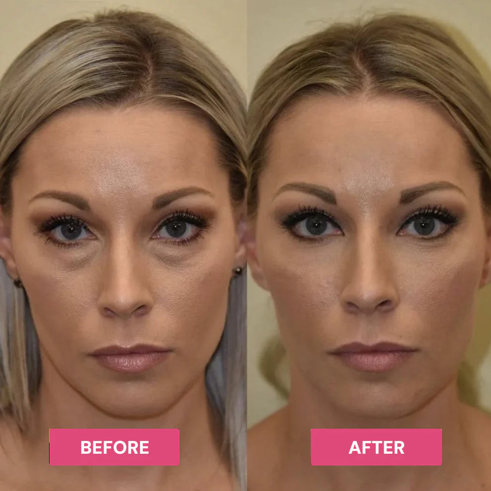 Revive Tired Eyes – Hydrating & Anti-Wrinkle Eye Balm